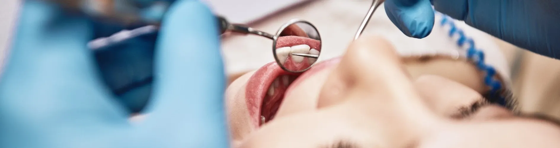 sprawdzanie uzębienia u dentysty lusterkiem